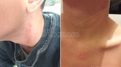 Minore “picchiato” dal bidello a Soriano, la dirigente replica a Marziale e la Nesci invoca un’ispezione