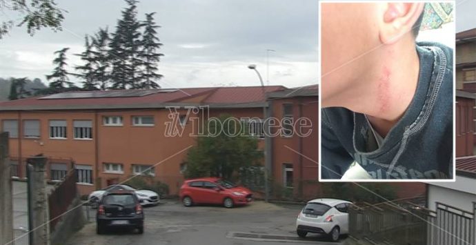 La brutta storia dell’aggressione nella scuola “anti-bullismo” di Soriano (VIDEO)