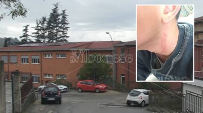 Minore “picchiato” a Soriano, la dirigente sanziona l’alunno: «Ferite provocate autonomamente»