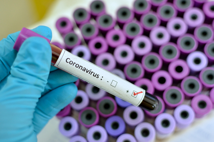 Coronavirus: nessun nuovo contagio nel Vibonese, 4 in più in Calabria