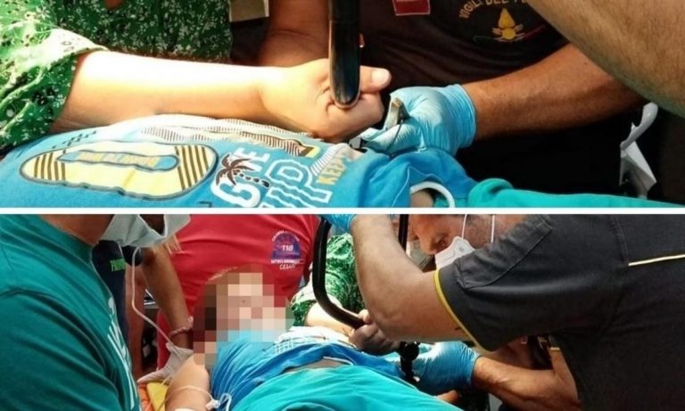 S’infilza il manubrio della bici nell’addome: bimbo salvato in Calabria da medici e vigili del fuoco