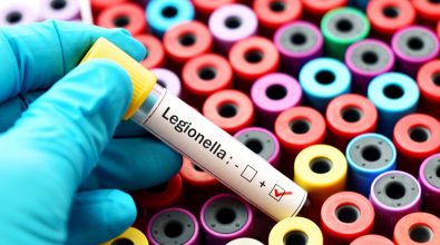 Legionella, un caso a Catanzaro: il sindaco vieta l’uso dell’abitazione