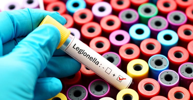 Legionella, un caso a Catanzaro: il sindaco vieta l’uso dell’abitazione