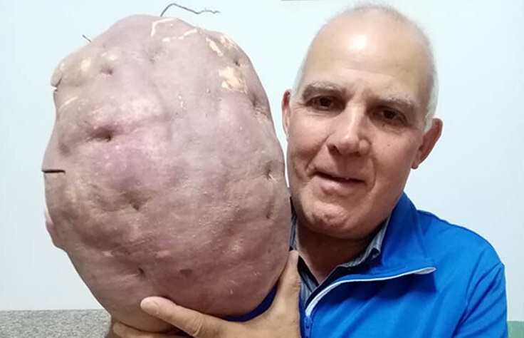 Patata da ben sette chili raccolta nel Vibonese
