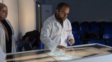 Tumore di 10 kg asportato dall’equipe del vibonese Bruno Nardo: intervento record a Cosenza