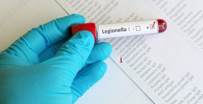 Vibo, servizio di monitoraggio della Legionella su campioni ambientali: l’Asp avvia l’iter
